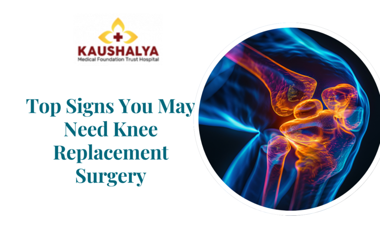  Top Signs You May Need Knee Replacement Surgery