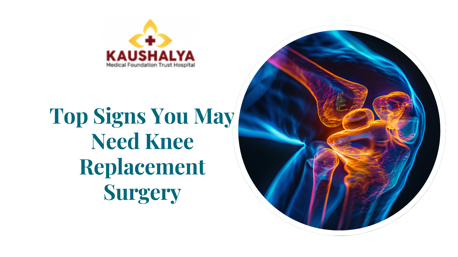 Top Signs You May Need Knee Replacement Surgery