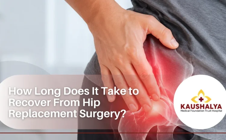  How Long Does It Take to Recover From Hip Replacement Surgery?