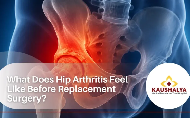  What Does Hip Arthritis Feel Like Before Replacement Surgery?