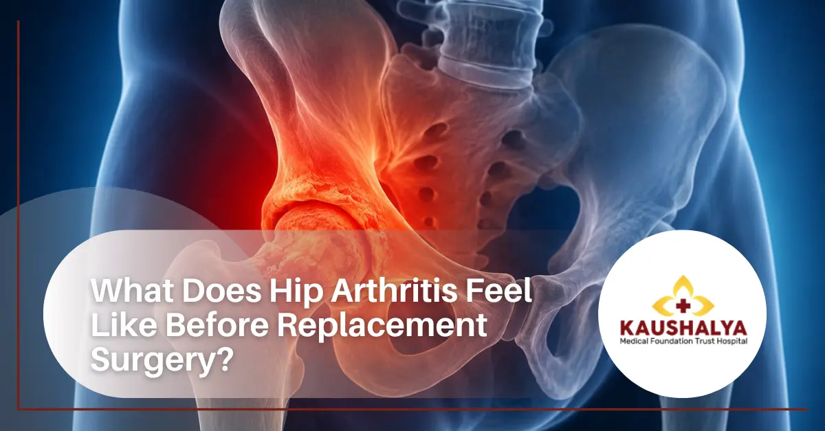 What Does Hip Arthritis Feel Like Before Replacement Surgery?